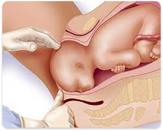 normal delivery img vr hospital